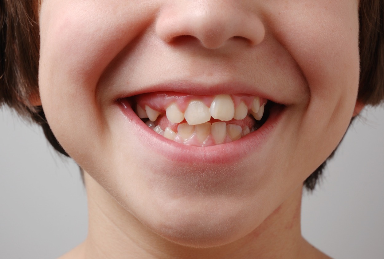 Is Your Child Ready For Orthodontic Care? Key Signs To Watch This 